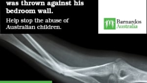Barnardos launches campaign to reveal harsh reality of child abuse